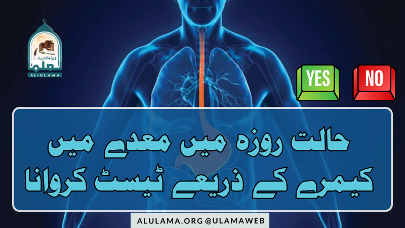 حالت روزہ میں معدے میں کیمرے کے ذریعے ٹیسٹ کروانا