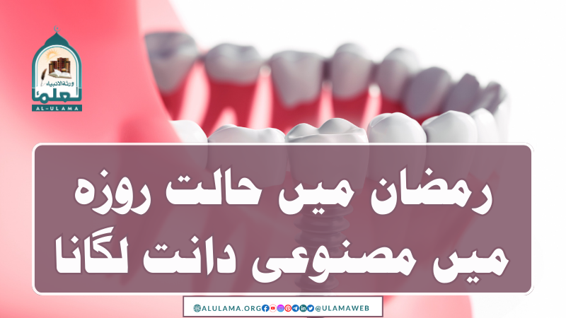 رمضان میں حالت روزہ میں مصنوعی دانت لگانا