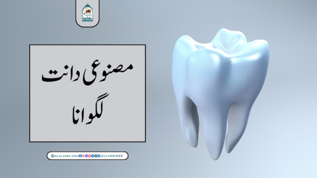 مصنوعی دانت لگوانا