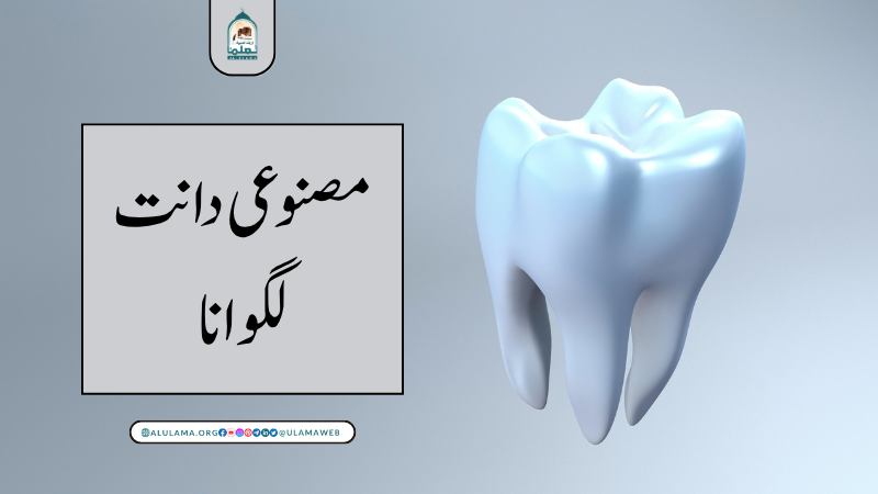 مصنوعی دانت لگوانا