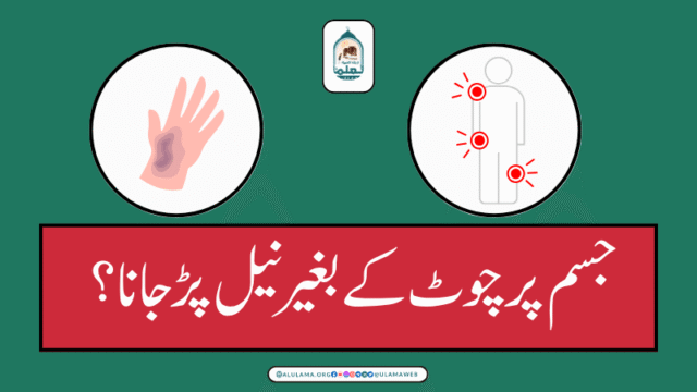 جسم پر چوٹ کے بغیر نیل پڑ جانا؟
