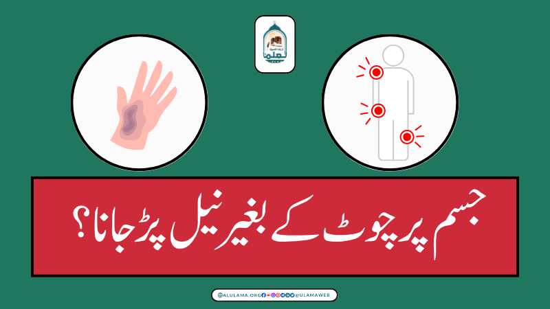 جسم پر چوٹ کے بغیر نیل پڑ جانا؟