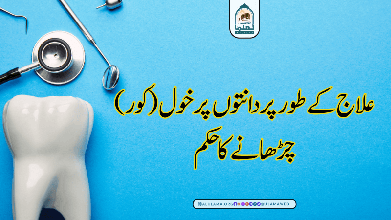 علاج کے طور پر دانتوں پر خول (کور) چڑھانے کا حکم علاج کے طور پر دانتوں پر خول (کور) چڑھانے کا حکم